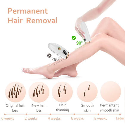 Laser hair removal